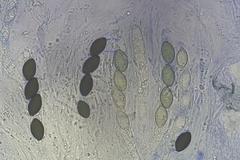 Podospora tetraspora