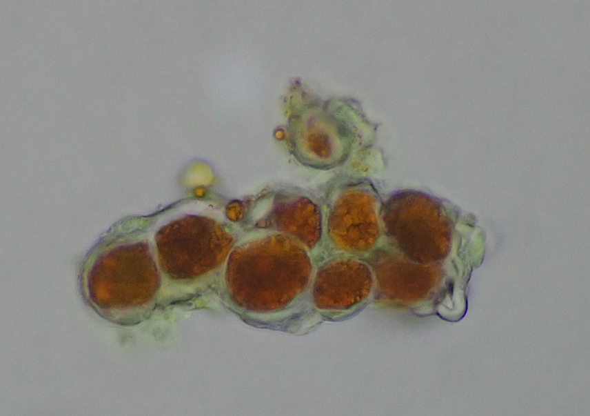 Trentepohlia umbrina