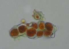 Trentepohlia umbrina