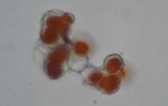 Trentepohlia umbrina