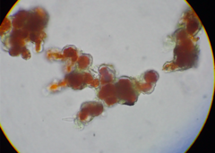 Trentepohlia umbrina