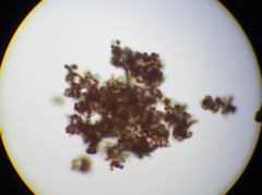 Trentepohlia umbrina