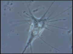 Amoebozoa