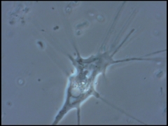 Amoebozoa