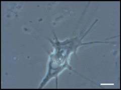 Amoebozoa
