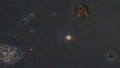 Cercozoa