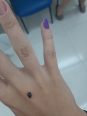 Chrysomelidae