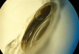 Anisus spirorbis