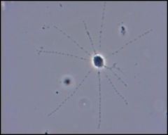 Cercozoa