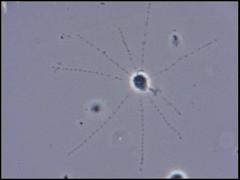 Cercozoa