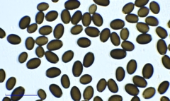 Coprinellus sclerocystidiosus