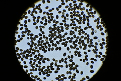 Coprinellus sclerocystidiosus