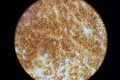 Phlegmacium patrickense