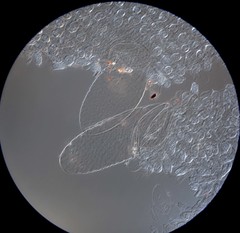 Coprinellus bipellis