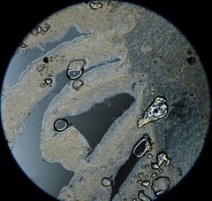 Coprinellus bipellis