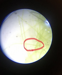 Stigeoclonium