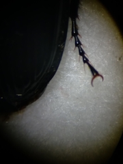 Pterostichus melanarius