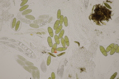 Pleomassaria carpini