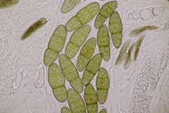Pleomassaria carpini