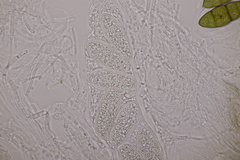 Pleomassaria carpini