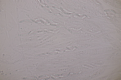 Ruzenia spermoides