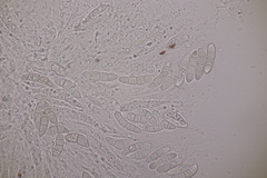 Fusarium sambucinum