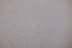 Fusarium sambucinum