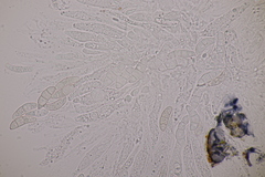Fusarium sambucinum