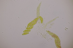 Fusarium sambucinum