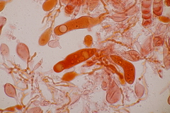 Aleurodiscus aurantius