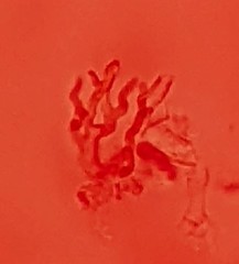 Peniophora albobadia
