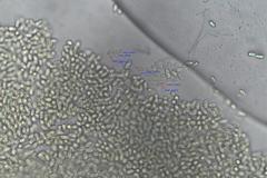 Pilobolus crystallinus