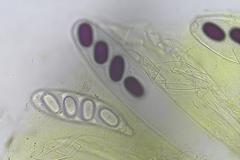 Ascobolus immersus
