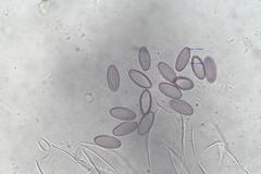 Ascobolus hawaiiensis