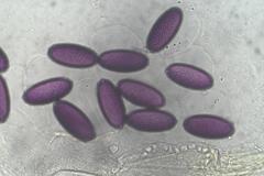 Ascobolus dadei