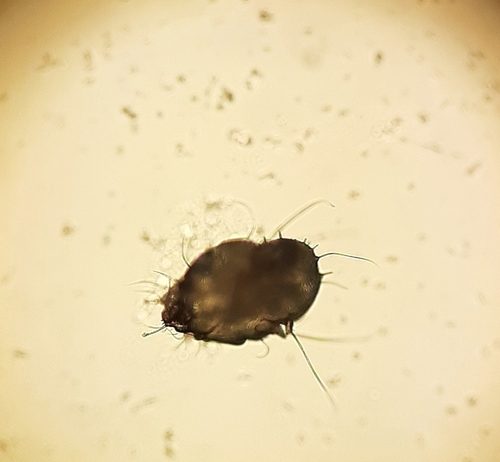 Scabies Mite