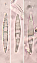 Lachnellula ellisiana