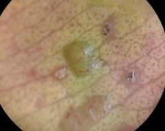 Epichrysocharis burwelli