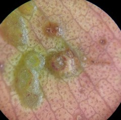 Epichrysocharis burwelli