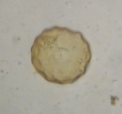 Arcella gibbosa