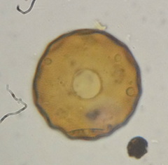 Arcella gibbosa