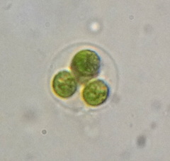 Asterococcus superbus