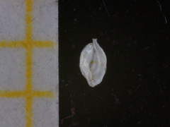 Spiroloculina