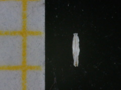 Spiroloculina