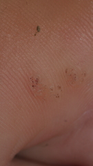 Firstpapillomavirinae