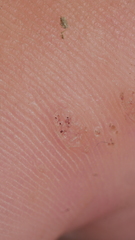 Firstpapillomavirinae