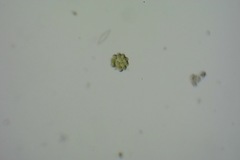 Coelastrum microporum