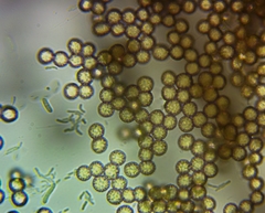 Tubifera ferruginosa acutissima