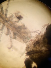 Ianiropsis serricaudis