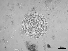Stylodictya multispina